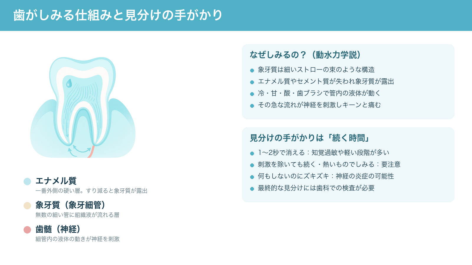 歯がしみる仕組み(象牙質の細管を液体が動いて神経を刺激する動水力学説)と、知覚過敏と虫歯を見分ける手がかりが「しみが続く時間」であることをまとめた解説図