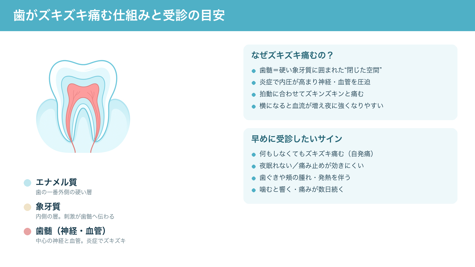 歯がズキズキ痛む仕組み（歯の三層構造と歯髄の炎症で内圧が高まること）と、早めに受診したいサインをまとめた解説図
