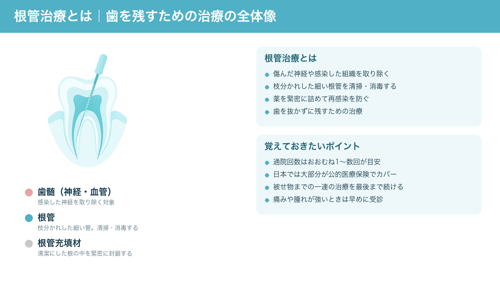 根管治療の全体像を示した解説図。歯の中心の歯髄から枝分かれした根管を清掃・消毒し、薬を緊密に詰めて再感染を防ぎ、歯を抜かずに残す治療であること