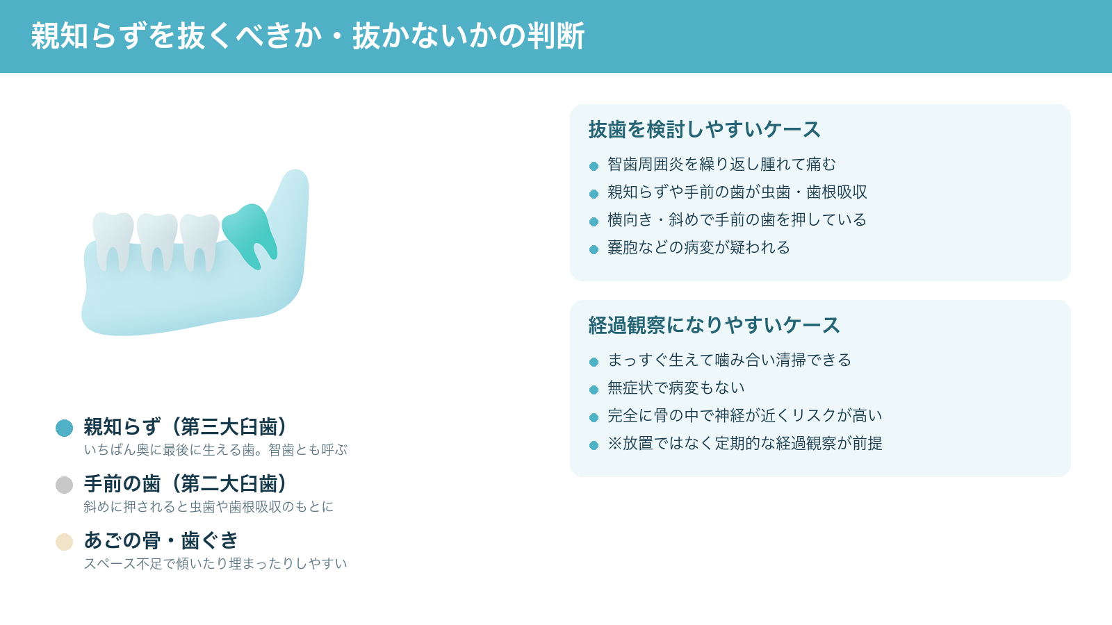親知らず（第三大臼歯）の生え方と、抜歯を検討しやすいケース・経過観察になりやすいケースを整理した解説図