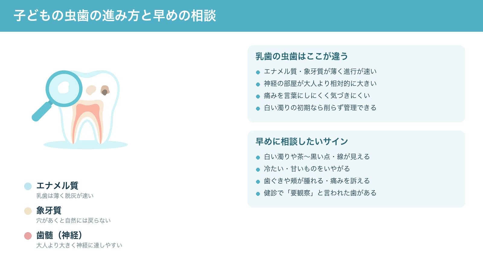 子どもの虫歯が初期の白い濁りから穴へと進む様子と、乳歯の特徴(エナメル質・象牙質が薄く神経が大きい)、早めに相談したいサインをまとめた解説図