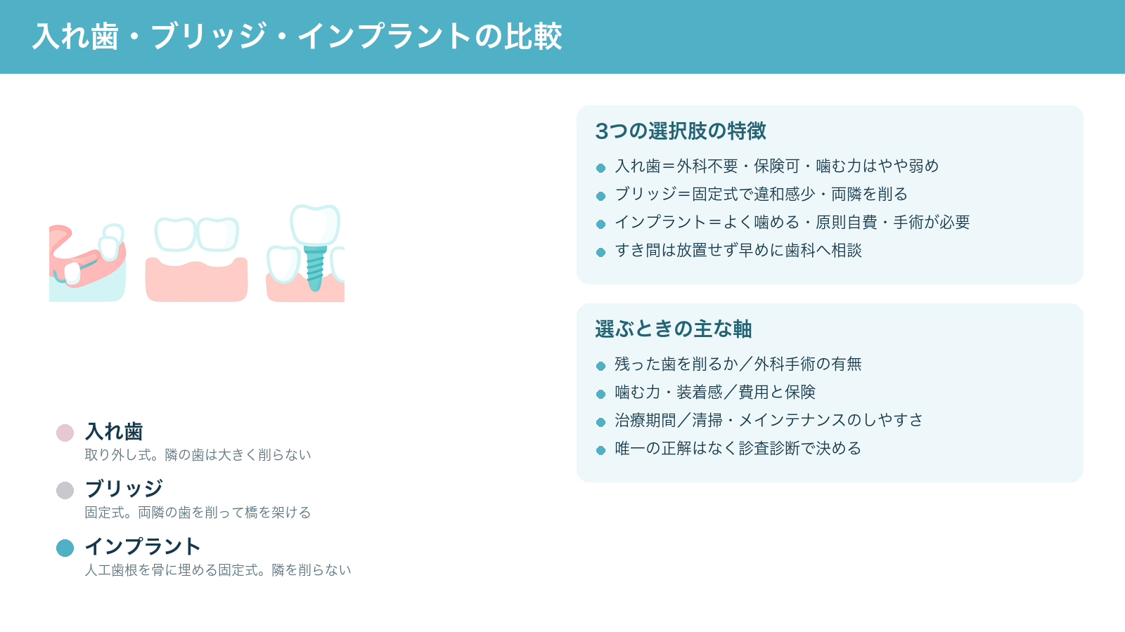 歯を失った後の3つの選択肢(入れ歯・ブリッジ・インプラント)を横並びで比較し、それぞれの仕組みと選ぶときの軸をまとめた解説図