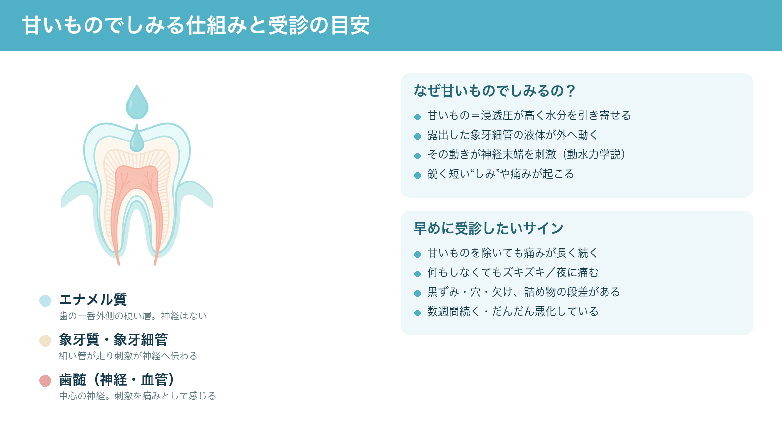 甘いものでしみる仕組み（露出した象牙細管の液体が浸透圧で動き神経を刺激すること）と、早めに受診したいサインをまとめた解説図