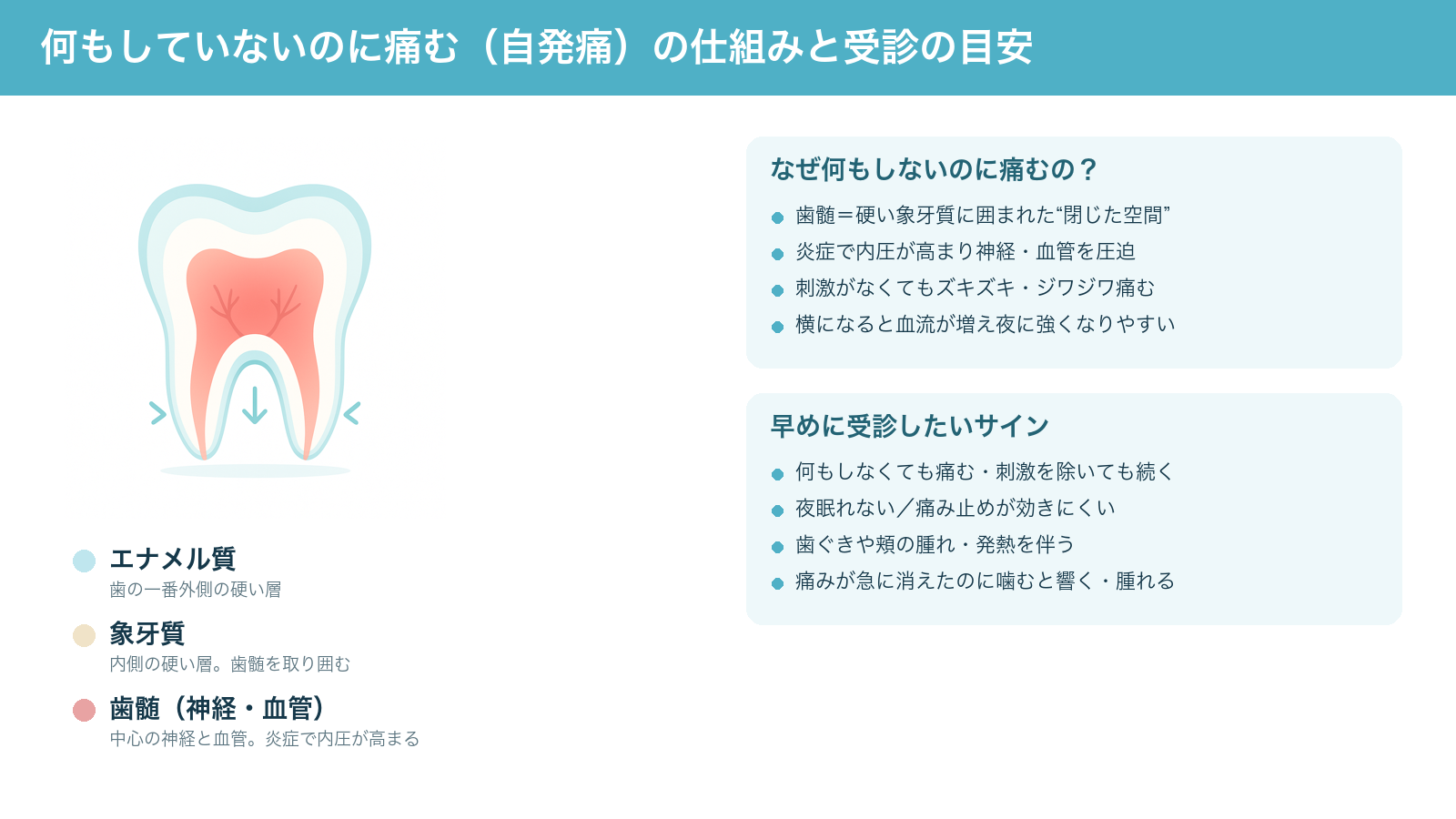 何もしていないのに歯が痛む自発痛の仕組み（歯の三層構造と、硬い象牙質に囲まれた歯髄の炎症で内圧が高まること）と、早めに受診したいサインをまとめた解説図