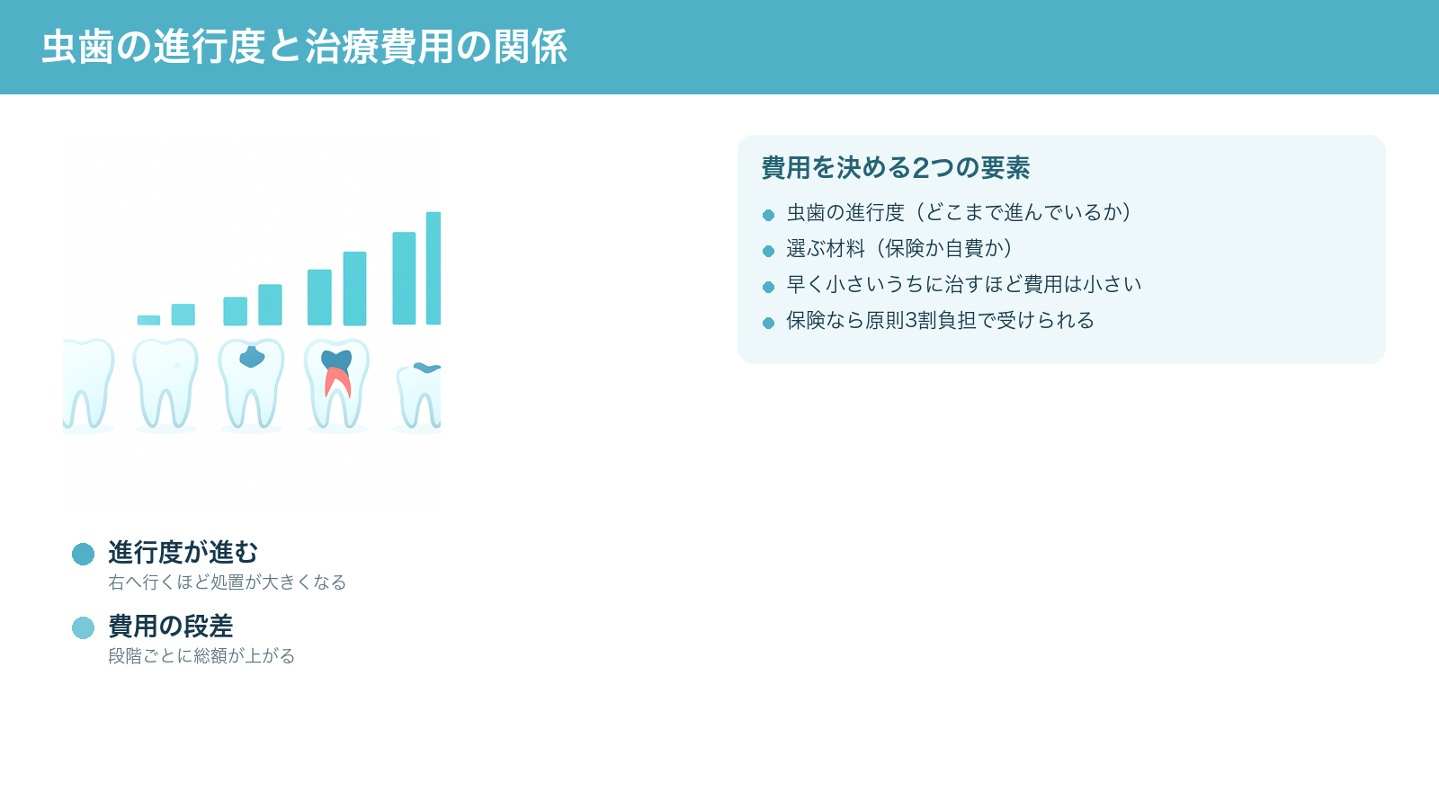 虫歯の進行度が進むほど治療の処置が大きくなり費用が段階的に増えていく関係と、費用を決める進行度・材料という2つの要素をまとめた解説図