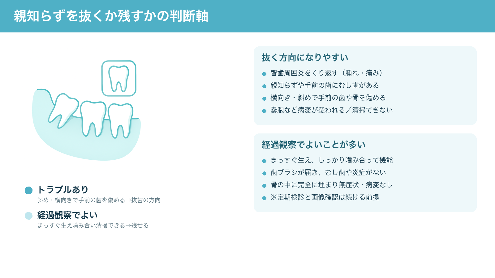 親知らずを抜くべきか経過観察でよいかの判断軸を示す解説図。斜めに生えて手前の歯を傷める親知らずは抜歯の方向、まっすぐ生え機能し清掃できる親知らずは経過観察でよいことを対比