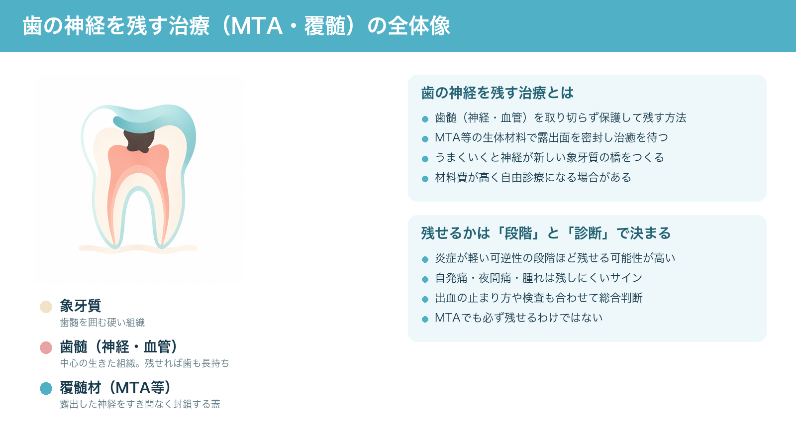 歯の神経を残す治療(MTA・覆髄)の全体像を示す解説図。深い虫歯で露出に近づいた歯髄をMTA等の覆髄材で密封し、その下に新しい象牙質ができる仕組みと、残せるかは炎症の段階と診断で決まることをまとめている
