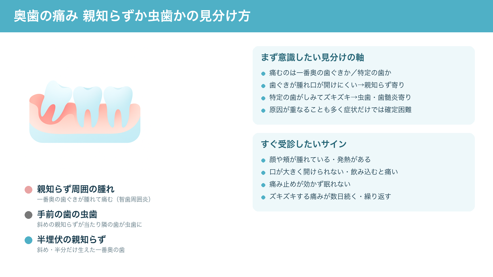 奥歯の痛みが親知らず（智歯周囲炎）由来か虫歯由来かを見分ける軸と、すぐ受診したいサインをまとめた解説図
