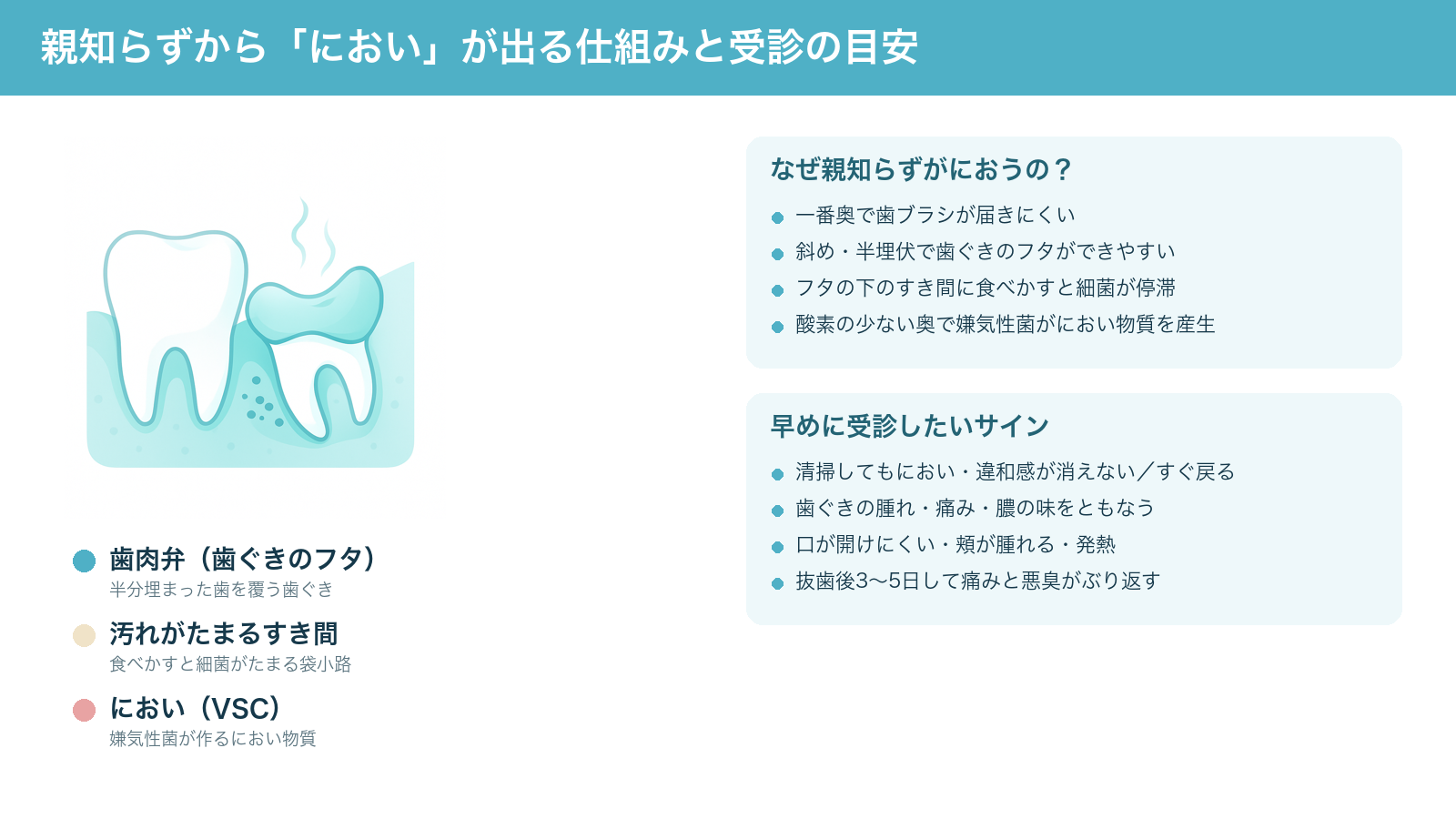 親知らずから「におい」が出る仕組み(半埋伏の歯と歯ぐきのフタの下のすき間に食べかすと細菌がたまり、嫌気性菌がにおい物質を作ること)と、早めに受診したいサインをまとめた解説図