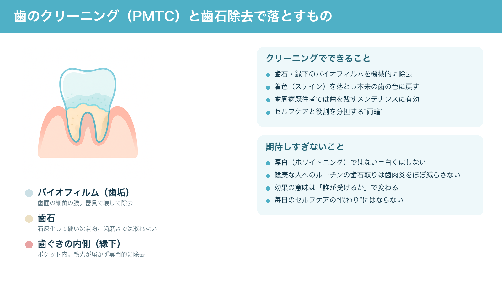 歯のクリーニング(PMTC)と歯石除去で落とすもの(歯面のバイオフィルム・歯石・歯ぐきの内側の沈着物)と、できること・期待しすぎないことをまとめた解説図