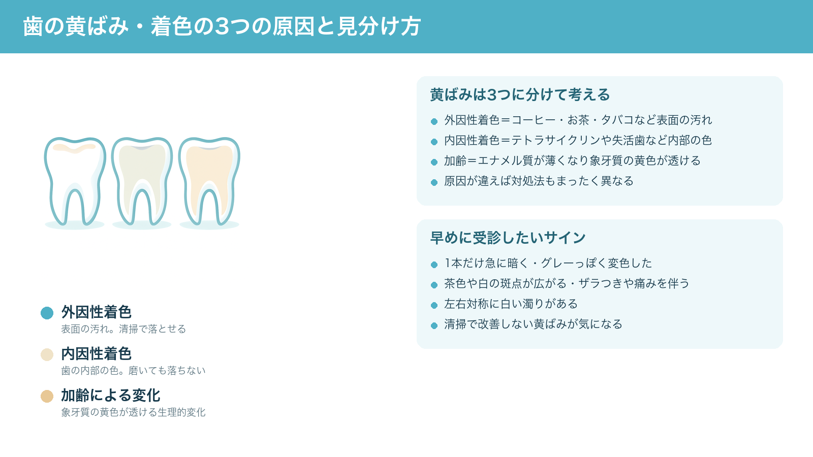 歯の黄ばみ・着色の3つの原因（表面の汚れによる外因性着色、歯の内部の色による内因性着色、加齢でエナメル質が薄くなり象牙質の黄色が透ける変化）と、早めに受診したいサインをまとめた解説図