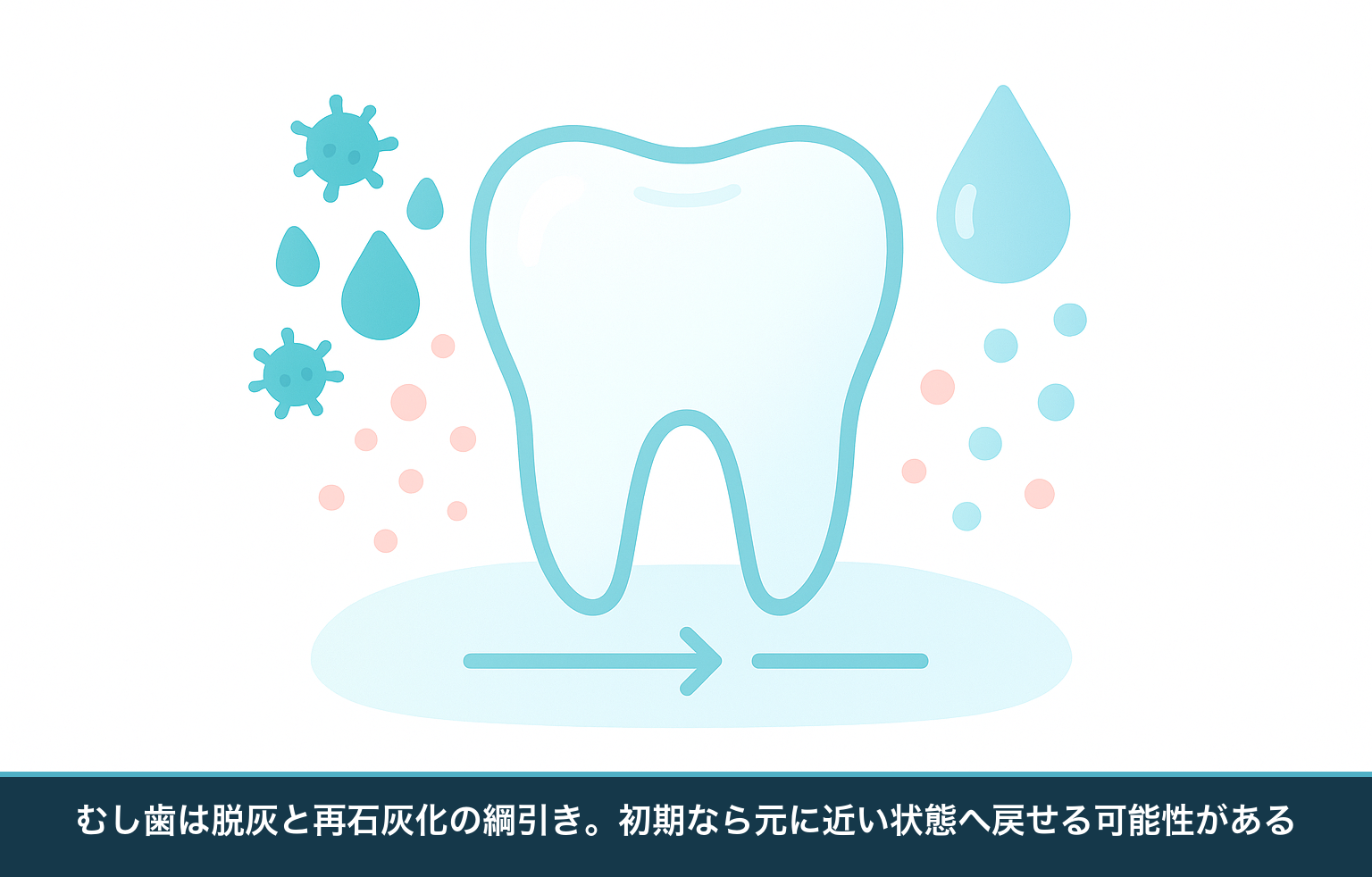 むし歯ができる仕組みの図。細菌の酸でエナメル質からミネラルが溶け出す脱灰と、だ液やフッ素がミネラルを戻す再石灰化が綱引きのように釣り合う様子