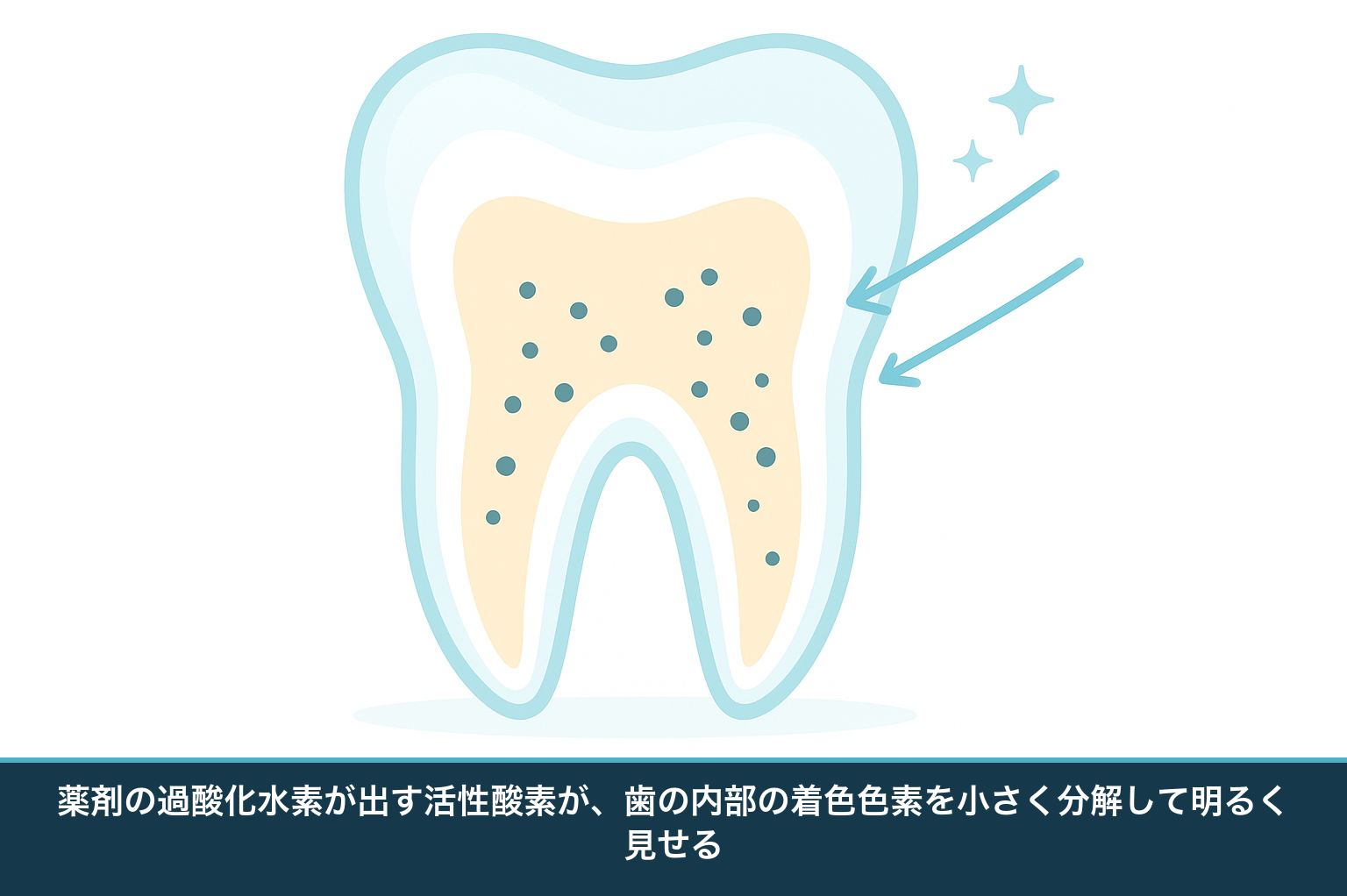 ホワイトニングの仕組みを示す歯の断面の模式図。エナメル質と象牙質の内部にしみ込んだ着色色素が、薬剤の作用で小さな分子へ分解され歯が明るく見える様子