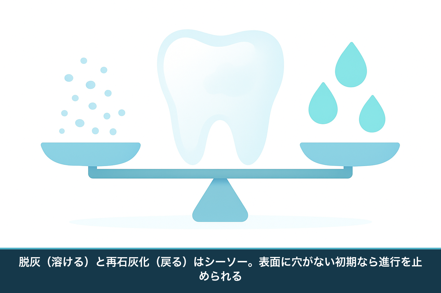 歯の脱灰と再石灰化のバランスを示す模式図。表面に穴がない初期の白濁なら再石灰化で進行を止められること