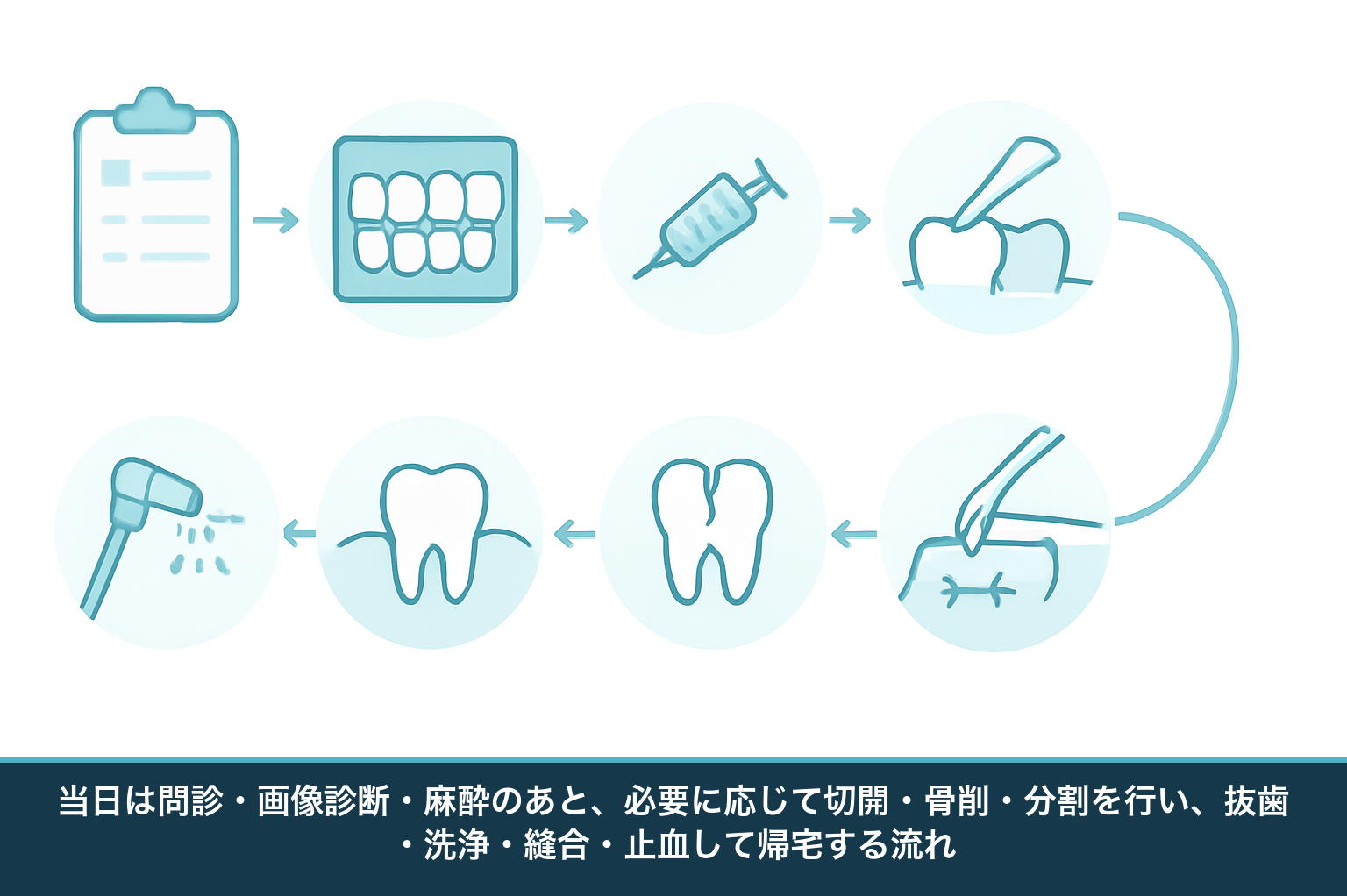 親知らず抜歯当日の流れの図。問診、レントゲン、局所麻酔、切開、骨削、歯の分割、抜歯、縫合、ガーゼでの止血までの手順を順番に示す