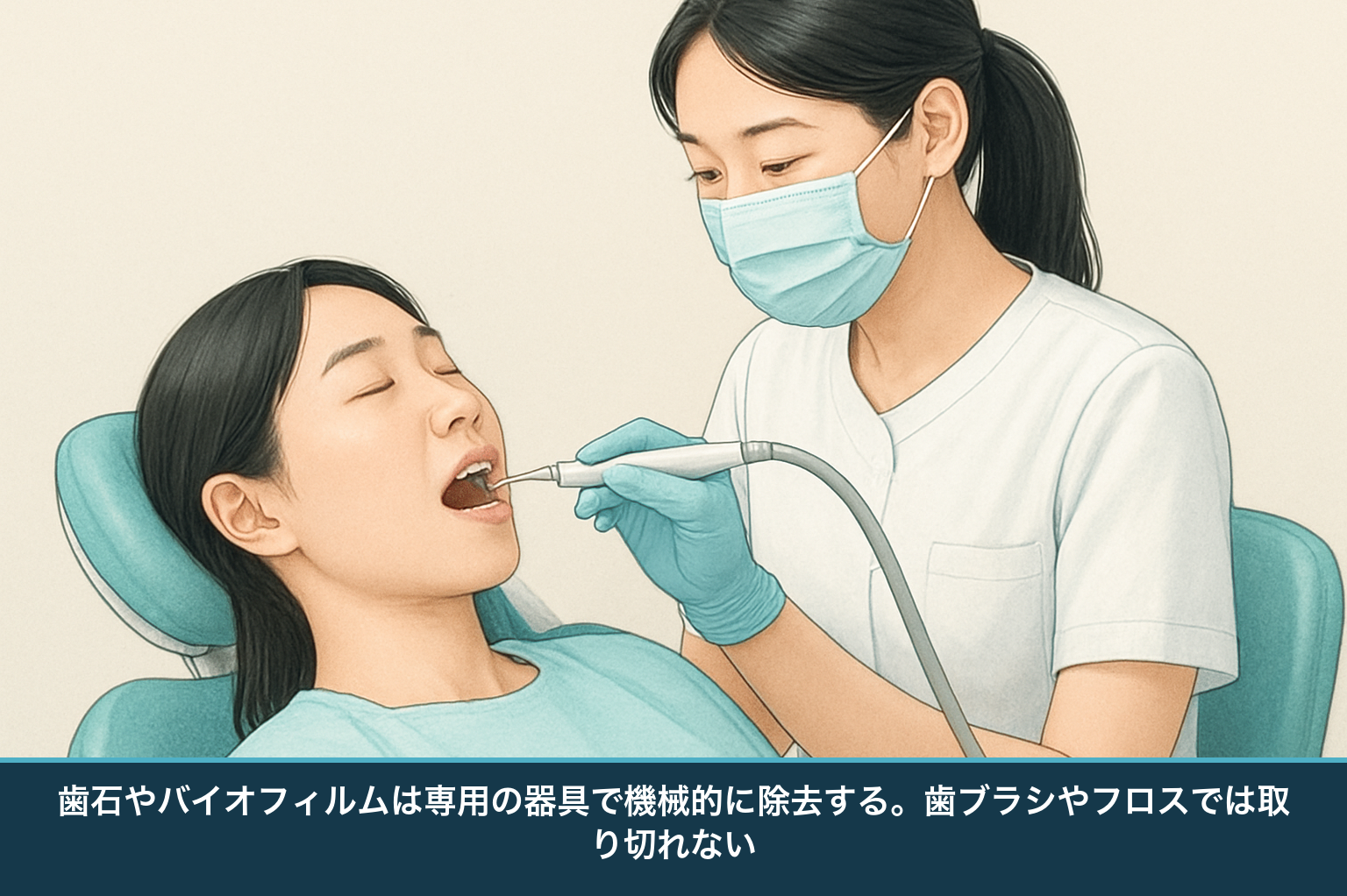歯科衛生士が患者に対し専門的な器具で歯のクリーニング・歯石除去を行う様子の図