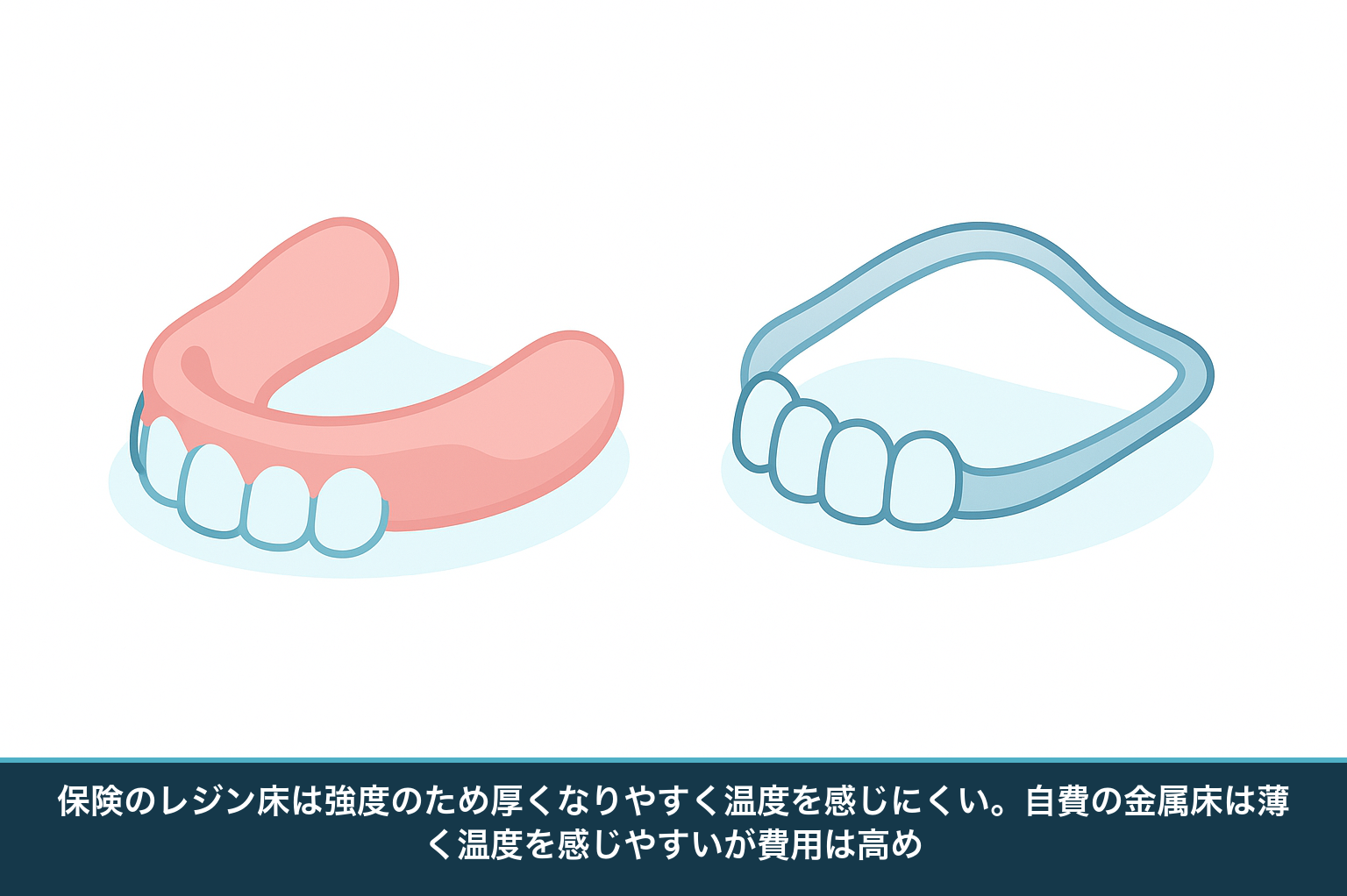 保険のレジン床の入れ歯と自費の金属床の入れ歯を並べて、床の厚みと特徴の違いを比較した図