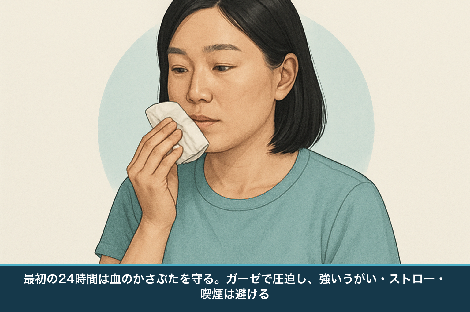 ドライソケット予防の応急処置の図。抜歯後はガーゼをしっかり噛んで止血し、最初の24時間は強いうがいやストロー、喫煙を避ける