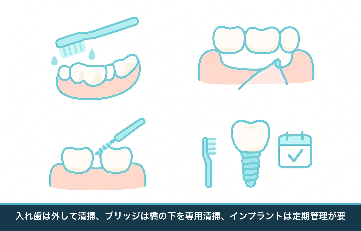 治療後の手入れを示す図。入れ歯は取り外して清掃、ブリッジはダミー歯の下を歯間ブラシで清掃、インプラントは定期的なメインテナンス